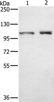 Gel: 6%SDS-PAGE Lysates (from left to right): Human testis tissue and K562 cell Amount of lysate: 40ug per lane Primary antibody: 1/650 dilution Secondary antibody dilution: 1/8000 Exposure time: 30 seconds
