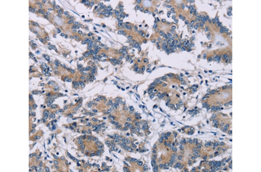 Immunohistochemistry - ODF2 Antibody from Signalway Antibody (36668) - Antibodies.com