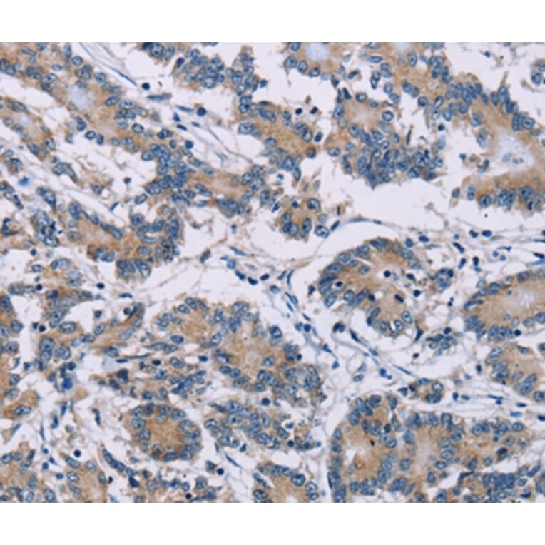 Immunohistochemistry - ODF2 Antibody from Signalway Antibody (36668) - Antibodies.com