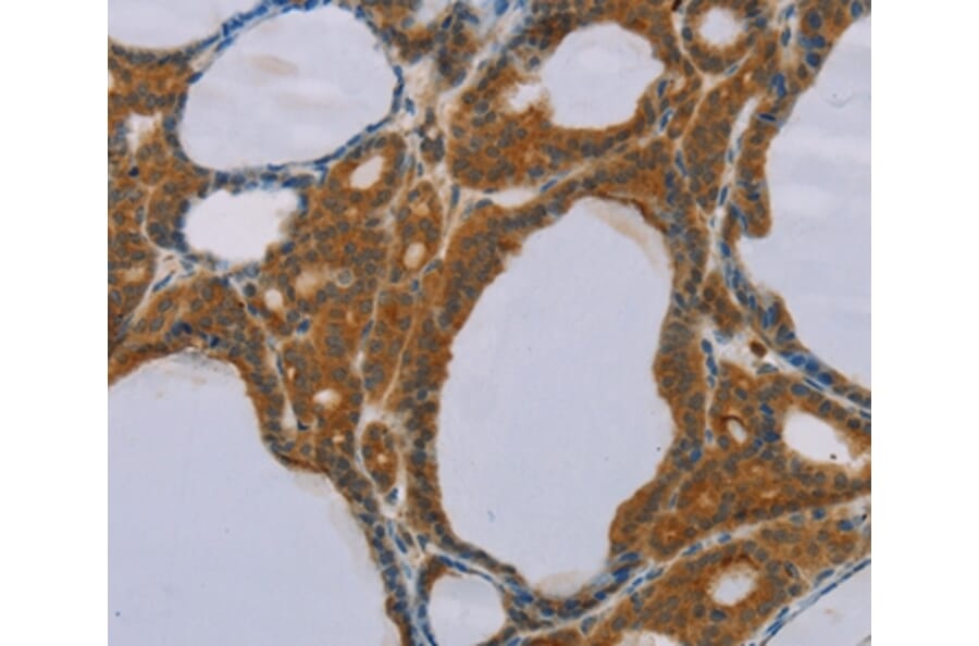 Immunohistochemistry - PEF1 Antibody from Signalway Antibody (36690) - Antibodies.com