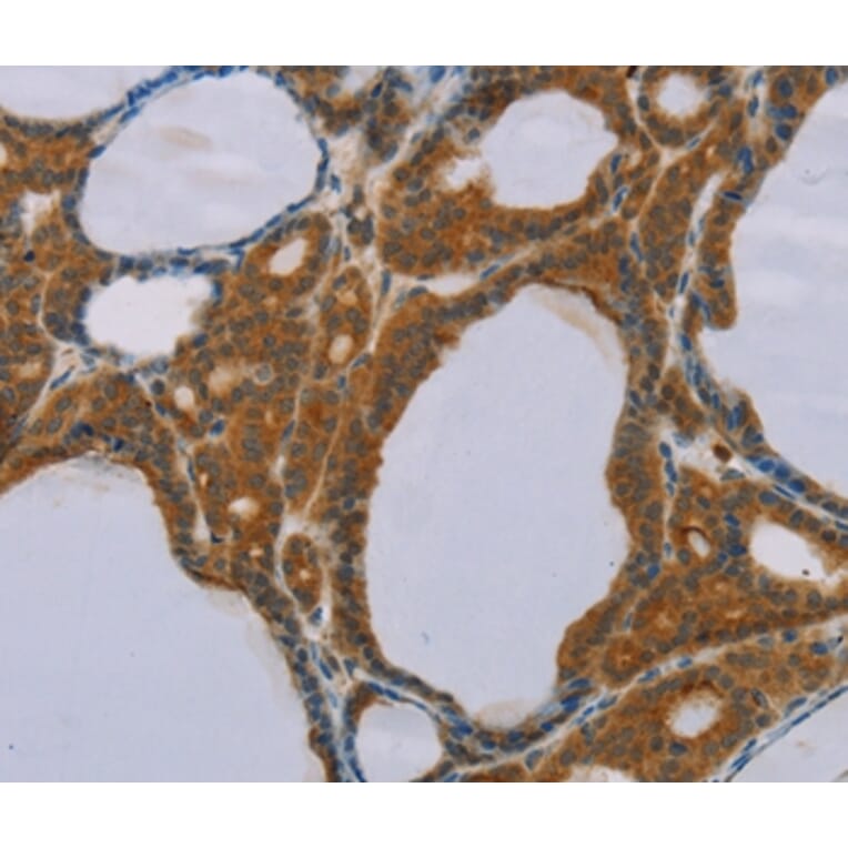 Immunohistochemistry - PEF1 Antibody from Signalway Antibody (36690) - Antibodies.com