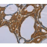 Immunohistochemistry - PEF1 Antibody from Signalway Antibody (36690) - Antibodies.com