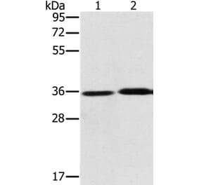 PHYH Antibody from Signalway Antibody (36694) - Antibodies.com