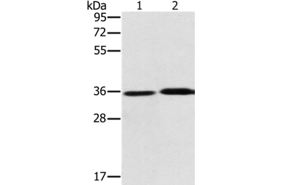 PHYH Antibody from Signalway Antibody (36694) - Antibodies.com