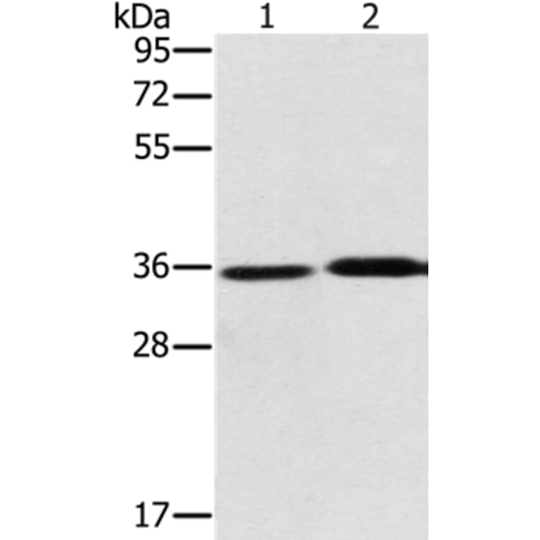 PHYH Antibody from Signalway Antibody (36694) - Antibodies.com