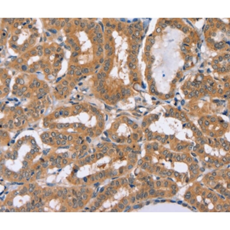 Immunohistochemistry - PHYH Antibody from Signalway Antibody (36694) - Antibodies.com