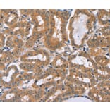 Immunohistochemistry - PHYH Antibody from Signalway Antibody (36694) - Antibodies.com