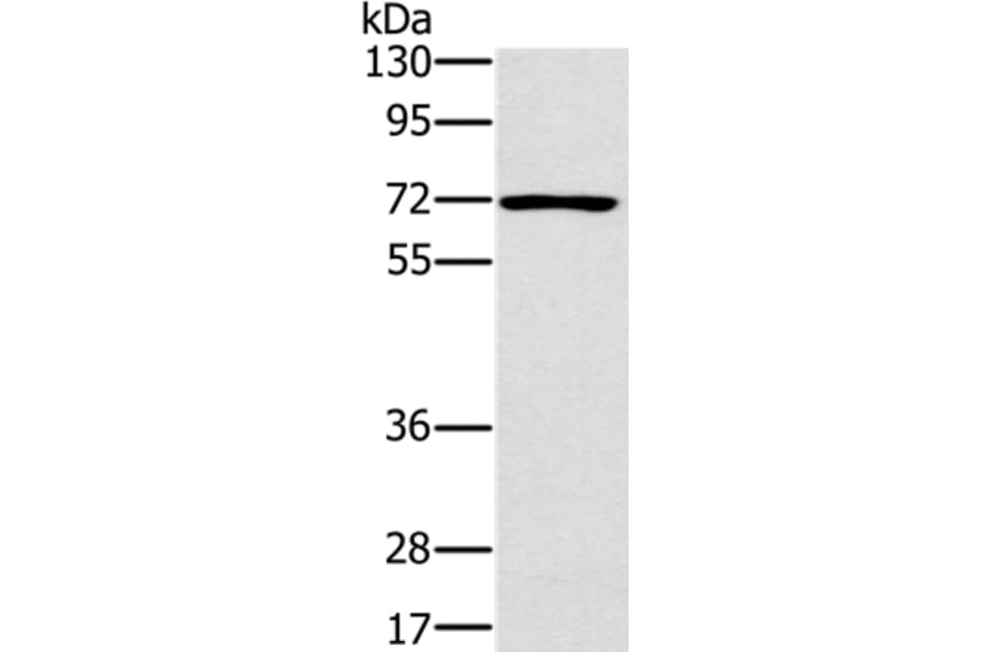 PLS3 Antibody from Signalway Antibody (36696) - Antibodies.com