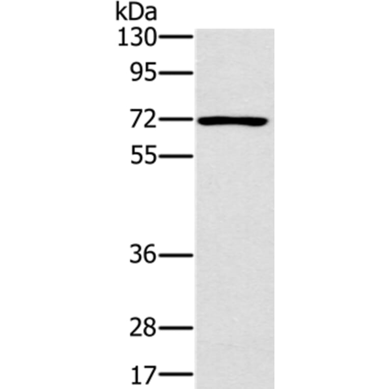 PLS3 Antibody from Signalway Antibody (36696) - Antibodies.com