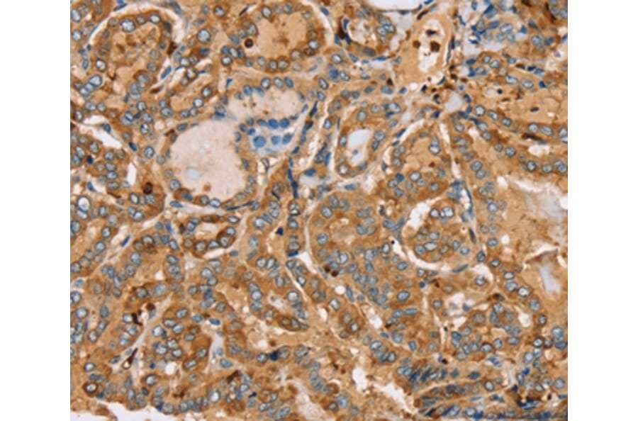 Immunohistochemistry - PLS3 Antibody from Signalway Antibody (36696) - Antibodies.com