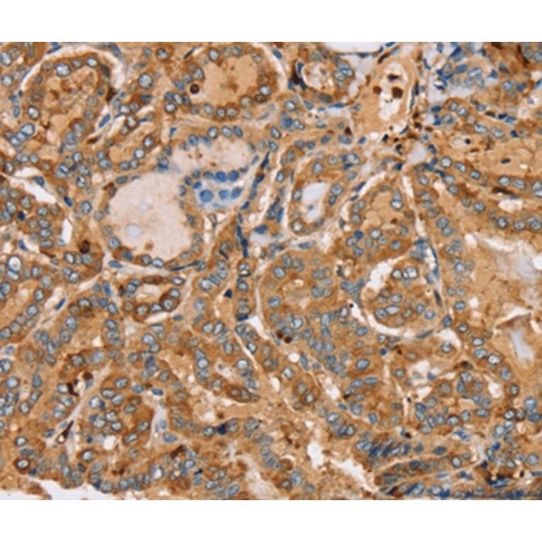 Immunohistochemistry - PLS3 Antibody from Signalway Antibody (36696) - Antibodies.com