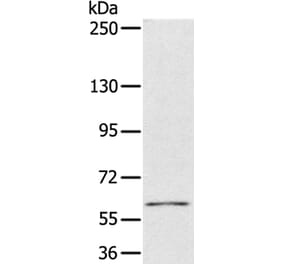 PDP1 Antibody from Signalway Antibody (36700) - Antibodies.com