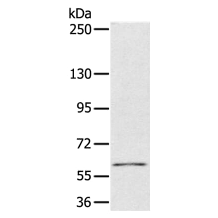 PDP1 Antibody from Signalway Antibody (36700) - Antibodies.com