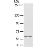 PDP1 Antibody from Signalway Antibody (36700) - Antibodies.com