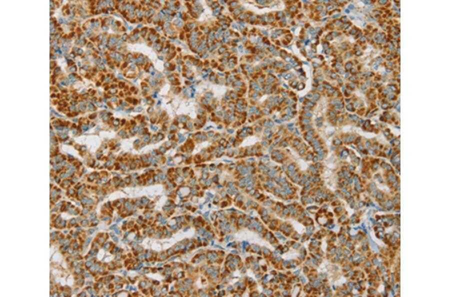 Immunohistochemistry - PDP1 Antibody from Signalway Antibody (36700) - Antibodies.com