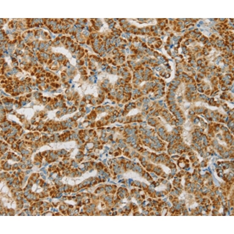 Immunohistochemistry - PDP1 Antibody from Signalway Antibody (36700) - Antibodies.com
