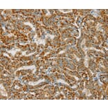Immunohistochemistry - PDP1 Antibody from Signalway Antibody (36700) - Antibodies.com
