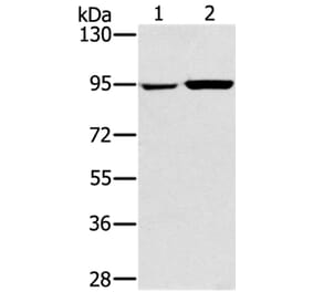 PYGL Antibody from Signalway Antibody (36709) - Antibodies.com