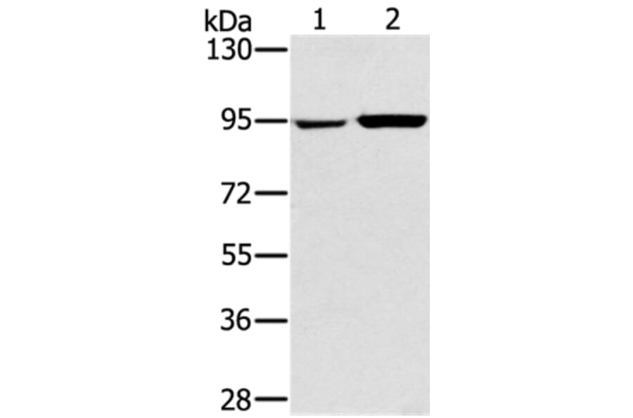 PYGL Antibody from Signalway Antibody (36709) - Antibodies.com