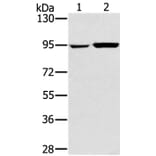 PYGL Antibody from Signalway Antibody (36709) - Antibodies.com