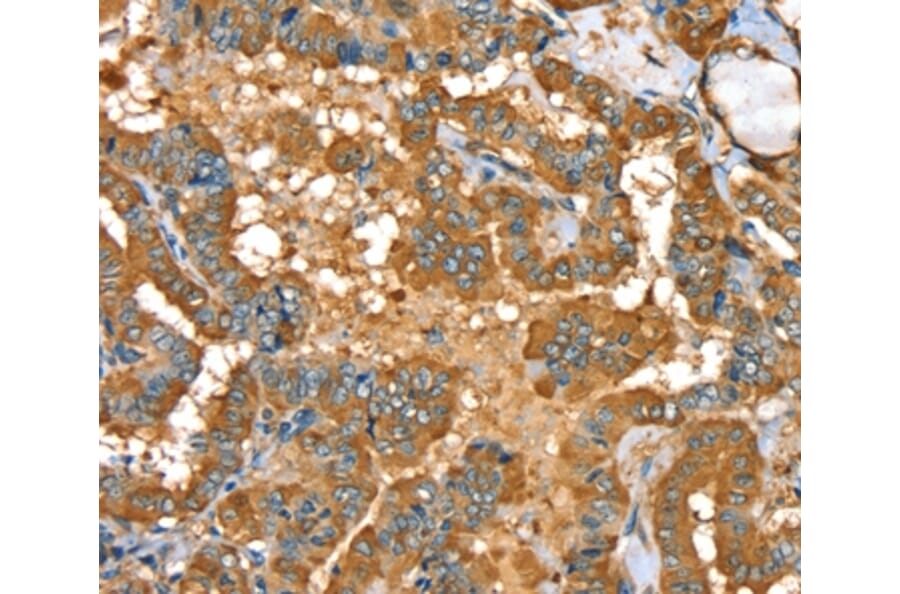 Immunohistochemistry - PYGL Antibody from Signalway Antibody (36709) - Antibodies.com