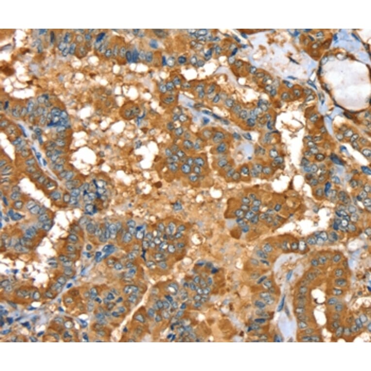 Immunohistochemistry - PYGL Antibody from Signalway Antibody (36709) - Antibodies.com