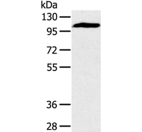 PYGM Antibody from Signalway Antibody (36710) - Antibodies.com