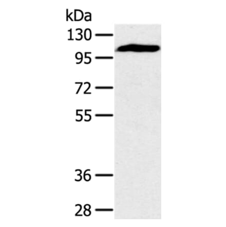 PYGM Antibody from Signalway Antibody (36710) - Antibodies.com