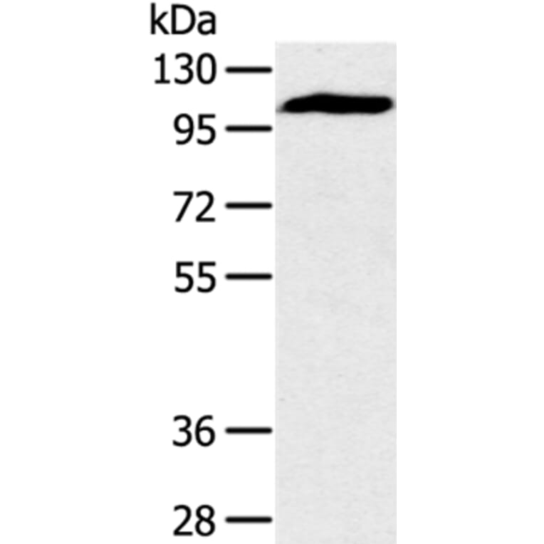 PYGM Antibody from Signalway Antibody (36710) - Antibodies.com