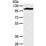 PYGM Antibody from Signalway Antibody (36710) - Antibodies.com