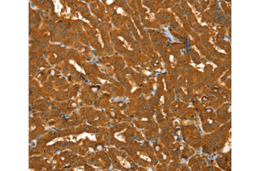 Immunohistochemistry - PYGM Antibody from Signalway Antibody (36710) - Antibodies.com