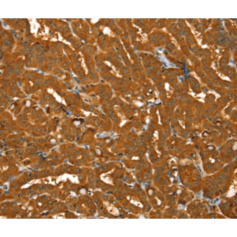 Immunohistochemistry - PYGM Antibody from Signalway Antibody (36710) - Antibodies.com