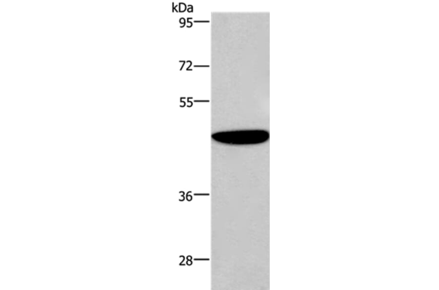 ABI1 Antibody from Signalway Antibody (36723) - Antibodies.com