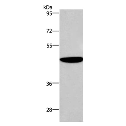 ABI1 Antibody from Signalway Antibody (36723) - Antibodies.com