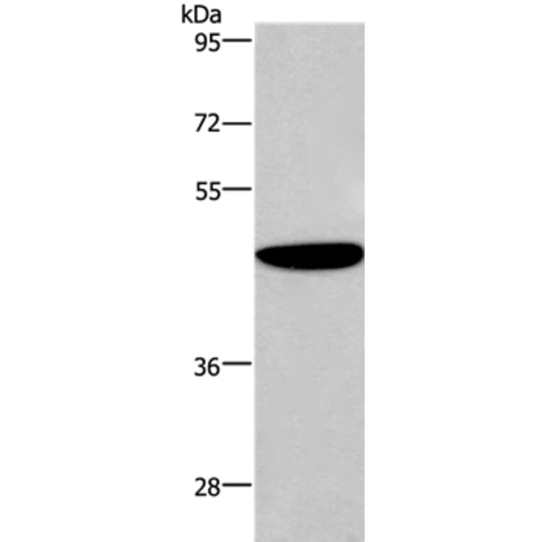 ABI1 Antibody from Signalway Antibody (36723) - Antibodies.com