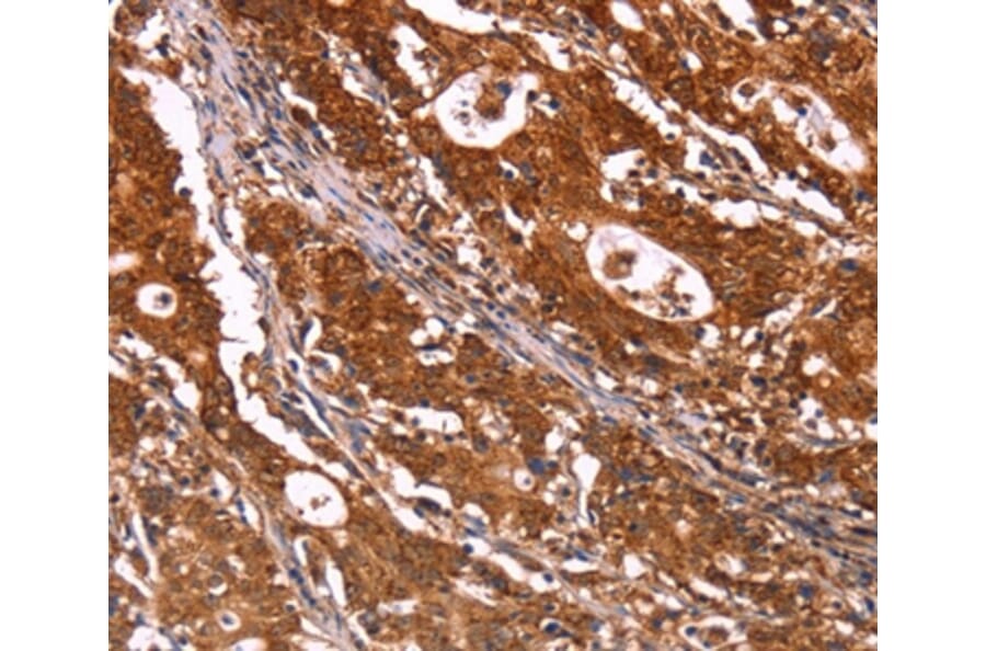 Immunohistochemistry - ABI1 Antibody from Signalway Antibody (36723) - Antibodies.com