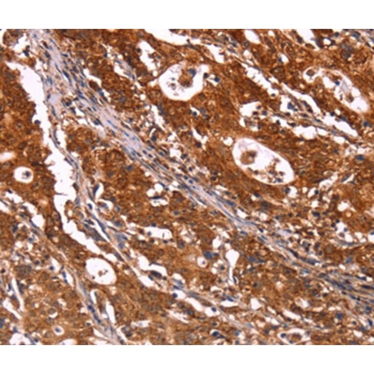 Immunohistochemistry - ABI1 Antibody from Signalway Antibody (36723) - Antibodies.com