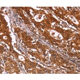 Immunohistochemistry - ABI1 Antibody from Signalway Antibody (36723) - Antibodies.com