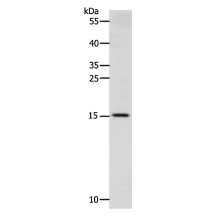 CST3 Antibody from Signalway Antibody (36752) - Antibodies.com