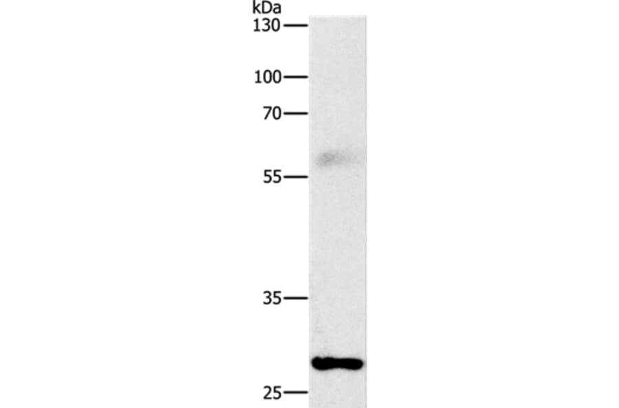 FGF2 Antibody from Signalway Antibody (36769) - Antibodies.com