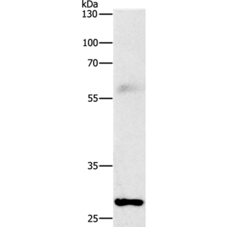 FGF2 Antibody from Signalway Antibody (36769) - Antibodies.com