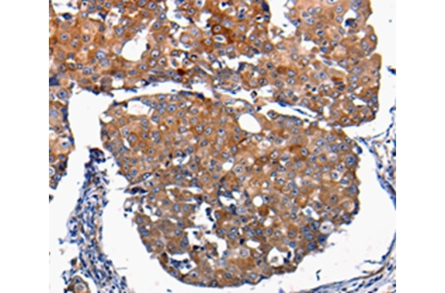 Immunohistochemistry - FGF2 Antibody from Signalway Antibody (36769) - Antibodies.com
