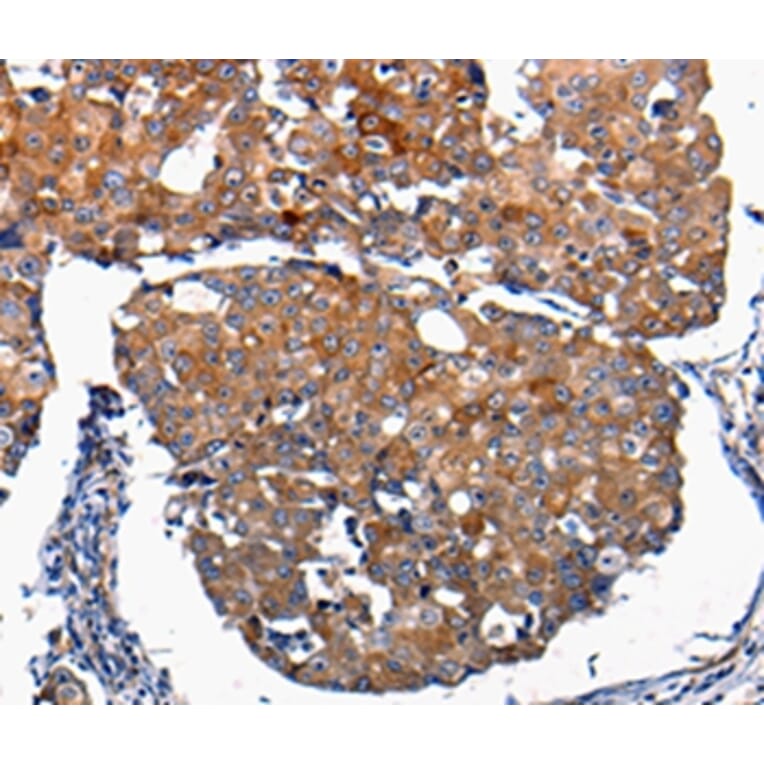 Immunohistochemistry - FGF2 Antibody from Signalway Antibody (36769) - Antibodies.com