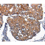 Immunohistochemistry - FGF2 Antibody from Signalway Antibody (36769) - Antibodies.com
