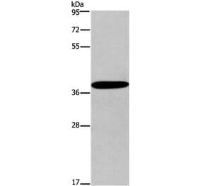 CCR2 Antibody from Signalway Antibody (36784) - Antibodies.com