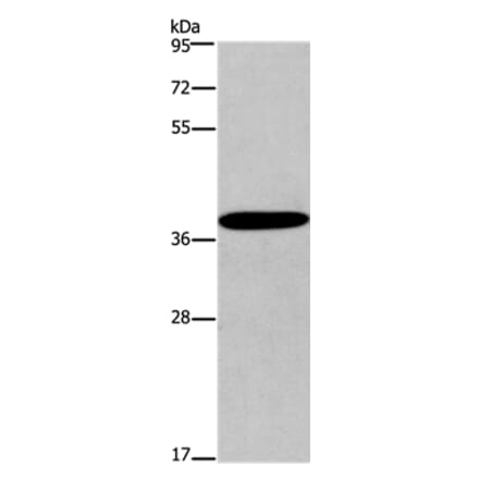 CCR2 Antibody from Signalway Antibody (36784) - Antibodies.com