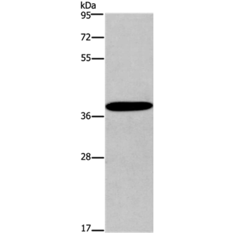 CCR2 Antibody from Signalway Antibody (36784) - Antibodies.com