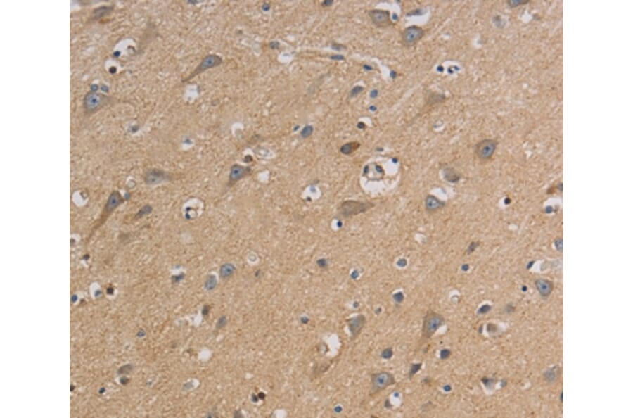 Immunohistochemistry - CCR2 Antibody from Signalway Antibody (36784) - Antibodies.com
