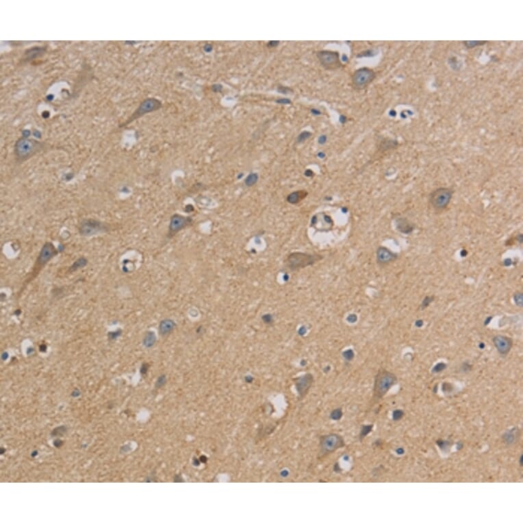 Immunohistochemistry - CCR2 Antibody from Signalway Antibody (36784) - Antibodies.com