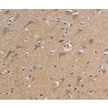 Immunohistochemistry - CCR2 Antibody from Signalway Antibody (36784) - Antibodies.com